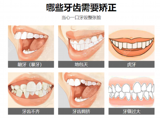 北京种牙实惠的牙科医院汇总！综合评价比较高的十家种牙医院及收费情况揭晓